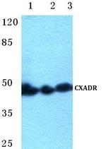 CAR Polyclonal Antibody