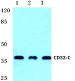 CD32c (FCGR2C) Polyclonal Antibody