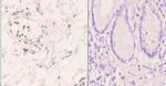 CRP1 Polyclonal Antibody