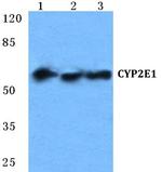 CYP2E1 Polyclonal Antibody