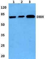 Dopamine beta Hydroxylase Polyclonal Antibody