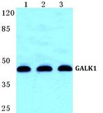 GALK1 Polyclonal Antibody