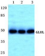 Glutamine Synthetase Polyclonal Antibody