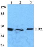 LIM1 Polyclonal Antibody