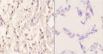 Menin Polyclonal Antibody