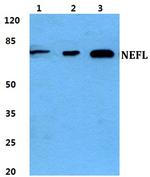 NEFL Antibody in Western Blot (WB)