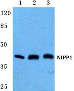 PPP1R8 Polyclonal Antibody