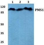 PMS1 Polyclonal Antibody