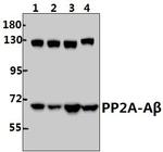PPP2R1B Polyclonal Antibody