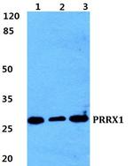 PRRX1 Antibody in Western Blot (WB)