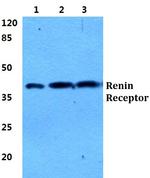 ATP6IP2 Polyclonal Antibody