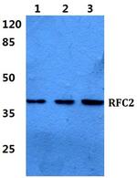RFC2 Polyclonal Antibody