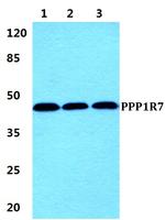 PPP1R7 Antibody in Western Blot (WB)