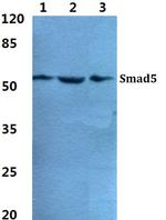 SMAD5 Polyclonal Antibody