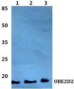 UBE2D2 Polyclonal Antibody