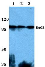 BAG3 Polyclonal Antibody