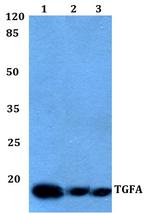 TGF alpha Polyclonal Antibody