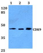 CDK9 Polyclonal Antibody