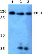 EphB3 Polyclonal Antibody