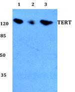 TERT Polyclonal Antibody