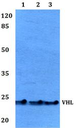 VHL Antibody in Western Blot (WB)