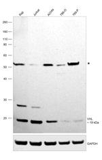 VHL Antibody in Western Blot (WB)