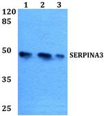 SERPINA3 Polyclonal Antibody