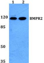 BMPR2 Polyclonal Antibody