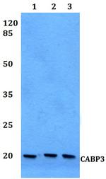 CABP5 Polyclonal Antibody