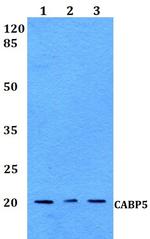 CABP5 Polyclonal Antibody