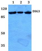 Desmoglein 3 Polyclonal Antibody