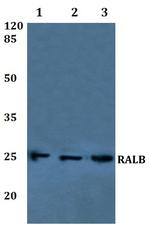 RALB Polyclonal Antibody