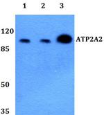 SERCA2 ATPase Polyclonal Antibody