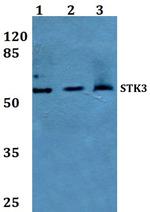 MST2 Polyclonal Antibody