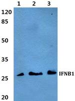 IFN beta Polyclonal Antibody