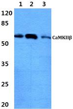 CaMKII beta Polyclonal Antibody