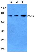 PAK6 Polyclonal Antibody