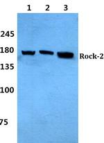 ROCK2 Polyclonal Antibody
