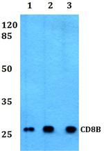 CD8 beta Antibody in Western Blot (WB)