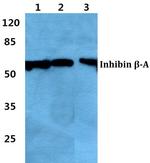 Activin A Polyclonal Antibody