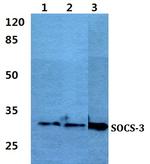 SOCS3 Polyclonal Antibody