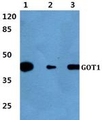 GOT1 Polyclonal Antibody