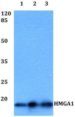 HMGA1 Polyclonal Antibody
