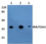 SULT2A1 Polyclonal Antibody