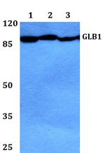 GLB1 Polyclonal Antibody