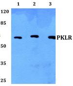 PKLR Antibody in Western Blot (WB)