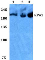 RPA70 Polyclonal Antibody
