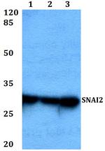SLUG Polyclonal Antibody