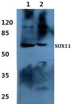SOX11 Polyclonal Antibody