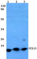 Eotaxin Polyclonal Antibody